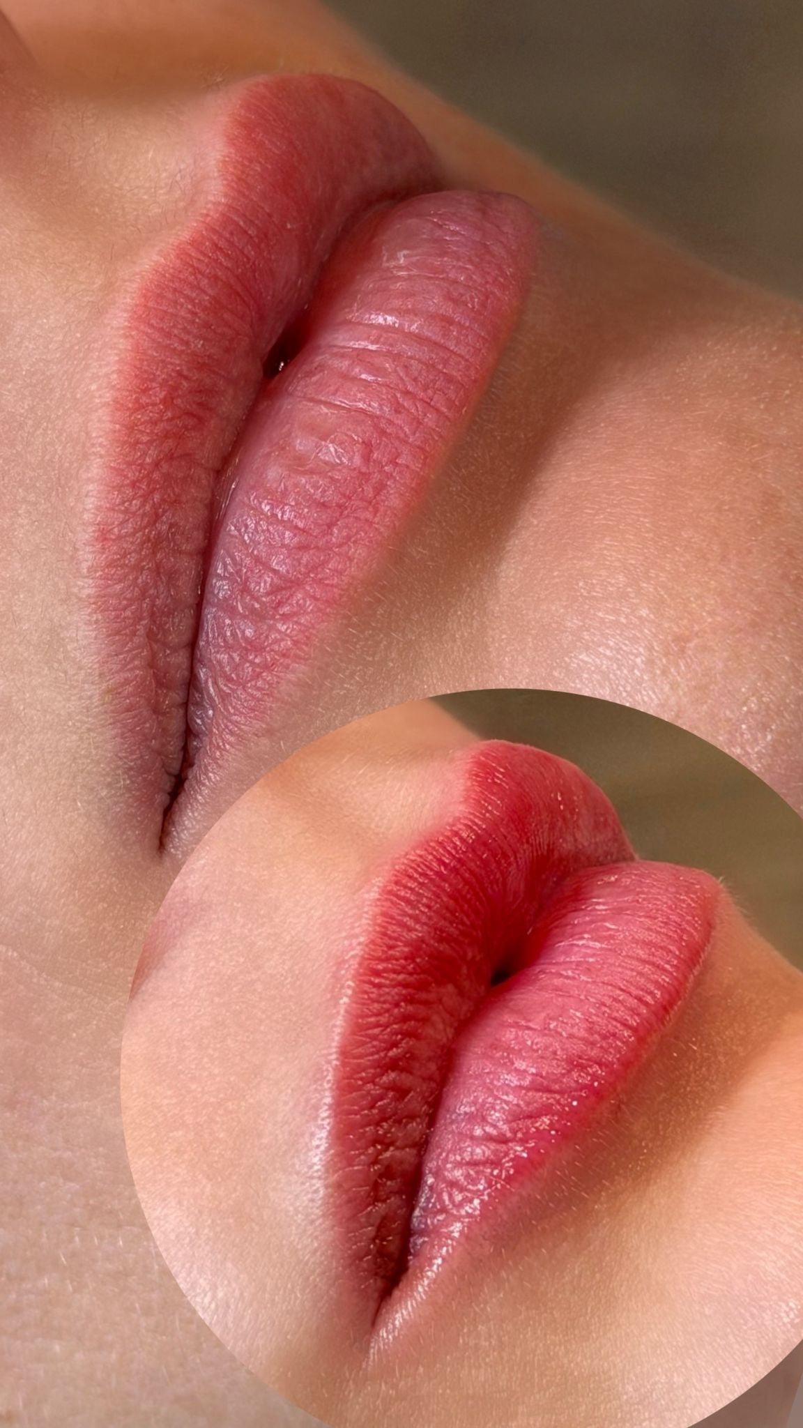 HydraLips