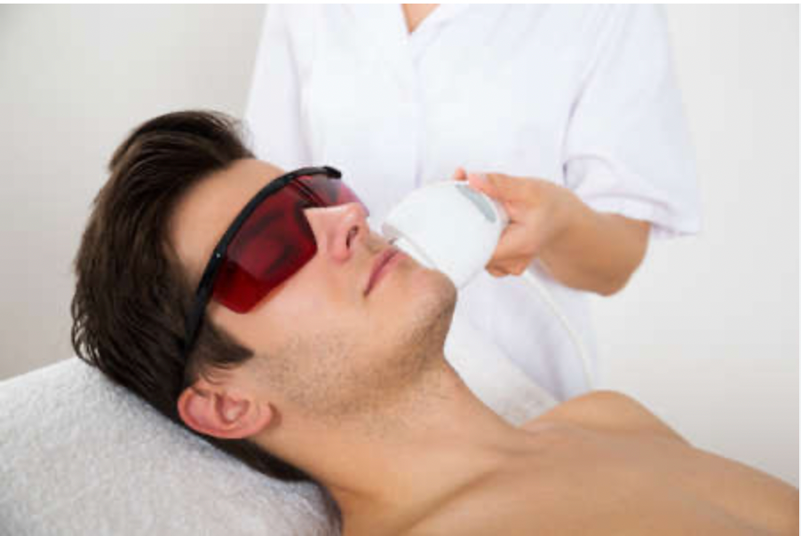 Beard Hair Removal (Men)