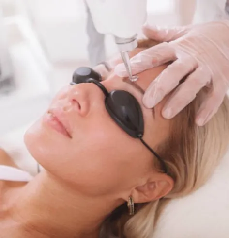 Láser cejas opiniones sale