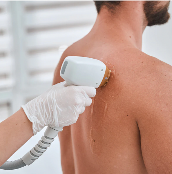 Laser Hair Removal Raleigh