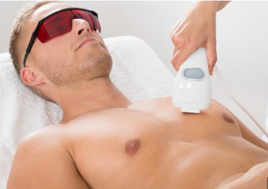 Chest Laser Hair Removal (Man)